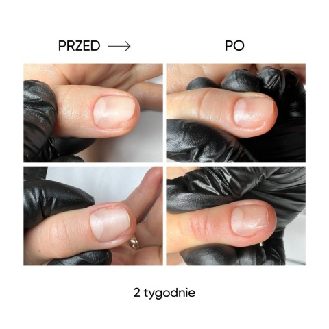 NAILSOFTHEDAY ONISTOP 8 ml – olejek regenerujący dla paznokci z onycholizą