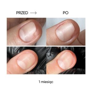 NAILSOFTHEDAY ONISTOP 8 ml – olejek regenerujący dla paznokci z onycholizą — zdjęcie 10