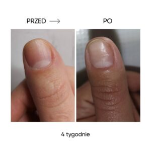 NAILSOFTHEDAY ONISTOP 8 ml – olejek regenerujący dla paznokci z onycholizą — zdjęcie 12