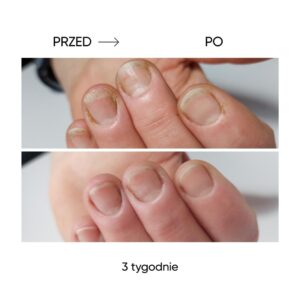 NAILSOFTHEDAY ONISTOP 8 ml – olejek regenerujący dla paznokci z onycholizą — zdjęcie 13