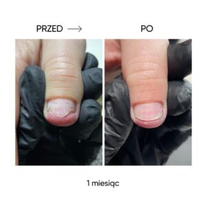 NAILSOFTHEDAY ONISTOP 15 ml – olejek regenerujący dla paznokci z onycholizą — zdjęcie 7