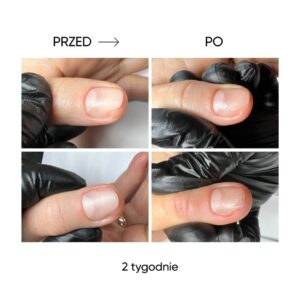 NAILSOFTHEDAY ONISTOP 15 ml – olejek regenerujący dla paznokci z onycholizą — zdjęcie 9
