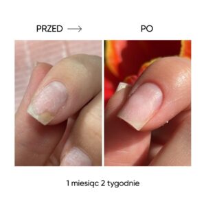 NAILSOFTHEDAY ONISTOP 15 ml – olejek regenerujący dla paznokci z onycholizą — zdjęcie 11